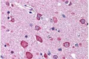 Brain, cortex (BRSK1 Antikörper  (C-Term))