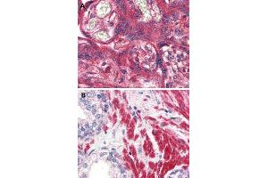 Immunohistochemical (Formalin/PFA-fixed paraffin-embedded sections) staining in human placenta (A) and human prostate (B) with OR51E1 polyclonal antibody . (OR51E1 Antikörper  (Internal Region))