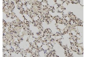 ABIN6279694 at 1/100 staining Rat lung tissue by IHC-P. (PPP1R2P3 Antikörper)