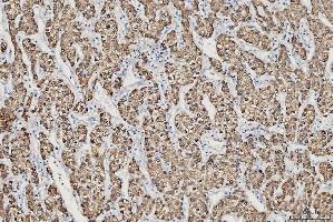 IHC analysis of CES2 using anti-CES2 antibody (ABIN7601024).
