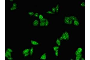 Immunofluorescent analysis of HepG2 cells using ABIN7162891 at dilution of 1:100 and Alexa Fluor 488-congugated AffiniPure Goat Anti-Rabbit IgG(H+L) (PLIN3 Antikörper  (AA 192-324))