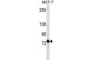 Western Blotting (WB) image for anti-ATP-Binding Cassette, Sub-Family B (MDR/TAP), Member 10 (ABCB10) antibody (ABIN3002510) (ABCB10 Antikörper)