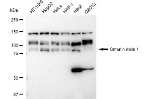 Western blotting analysis using Catenin delta 1 antibody (ABIN7797934). (Rekombinanter CTNND1 Antikörper)