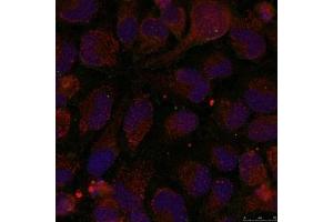 Immunofluorescence staining of methanol-fixed Hela cells using GATA1(Phospho-Ser142) Antibody. (GATA1 Antikörper  (pSer142))