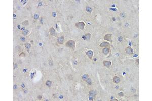 Immunohistochemistry analysis of paraffin-embedded mouse brain using DLG4 Polyclonal Antibody at dilution of 1:100. (DLG4 Antikörper)