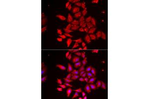 Immunofluorescence analysis of U2OS cells using TMOD4 antibody. (Tropomodulin 4 Antikörper)