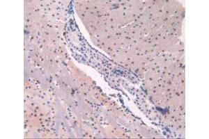 IHC-P analysis of Mouse Brain Tissue, with DAB staining. (ADK Antikörper  (AA 1-361))