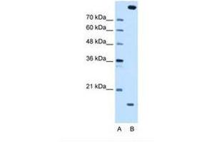 Image no. 1 for anti-Melanoma Inhibitory Activity Protein 2 (MIA2) (AA 413-462) antibody (ABIN6738411) (MIA2 Antikörper  (AA 413-462))