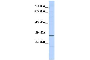 WB Suggested Anti-MED6 Antibody Titration:  0. (MED6 Antikörper  (Middle Region))