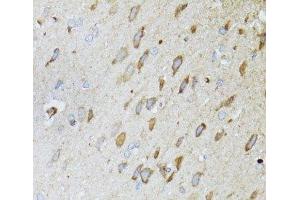 Immunohistochemistry of paraffin-embedded Rat brain using MT-ND5 Polyclonal Antibody at dilution of 1:100 (40x lens). (MT-ND5 Antikörper)