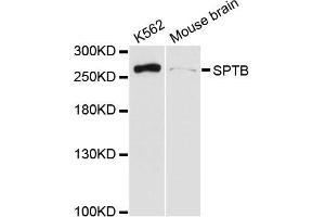Western blot analysis of extracts of various cell lines, using SPTB antibody (ABIN6290966) at 1:3000 dilution.