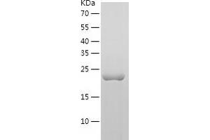 Western Blotting (WB) image for Muscle RAS Oncogene Homolog (MRAS) (AA 1-205) protein (His tag) (ABIN7284310) (MRAS Protein (AA 1-205) (His tag))