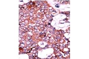 Image no. 2 for anti-Cell Division Cycle 25 Homolog A (S. Pombe) (CDC25A) (pSer76) antibody (ABIN358097) (CDC25A Antikörper  (pSer76))