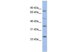 WB Suggested Anti-PPM1K Antibody Titration: 0. (PPM1K Antikörper  (Middle Region))