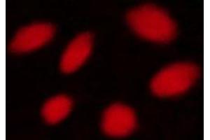 Immunofluorescence (fixed cells) (IF/ICC) image for anti-serine/threonine Kinase 11 (STK11) (pSer428) antibody (ABIN6255329)