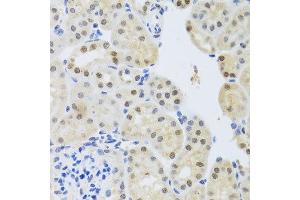 Immunohistochemistry (IHC) image for anti-SET Nuclear Oncogene (SET) antibody (ABIN1882339)