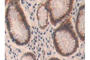 Immunohistochemistry (IHC) image for anti-Oncoprotein Induced Transcript 3 (OIT3) (AA 297-506) antibody (ABIN7434002)