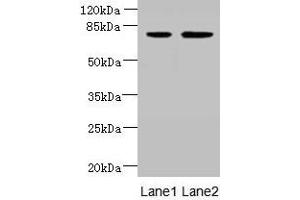 Western blot All lanes: ARMC9 antibody at 6 μg/mL Lane 1: Jurkat whole cell lysate Lane 2: CEM whole cell lysate Secondary Goat polyclonal to rabbit IgG at 1/10000 dilution Predicted band size: 92, 76 kDa Observed band size: 76 kDa (ARMC9 Antikörper  (AA 401-665))