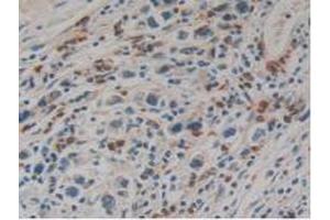 Figure. (Kallikrein 10 Antikörper  (AA 35-276))