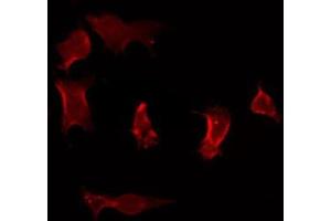 ABIN6275919 staining Hela by IF/ICC. (CCR7 Antikörper  (Internal Region))
