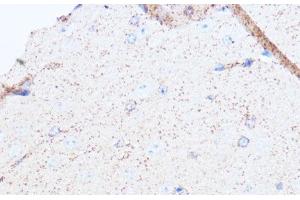 Immunohistochemistry (Paraffin-embedded Sections) (IHC (p)) image for anti-Monoamine Oxidase A (MAOA) antibody (ABIN7008332)