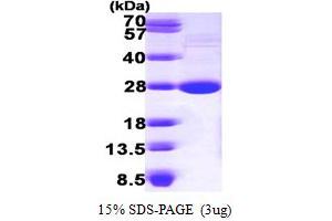SDS-PAGE (SDS) image for Lysophospholipase I (LYPLA1) (AA 1-230) protein (His tag) (ABIN667215)