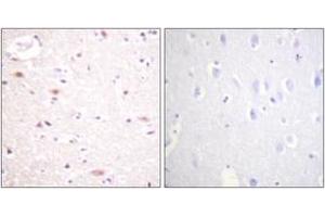 Immunohistochemistry analysis of paraffin-embedded human brain, using CDC16/APC6 (Phospho-Ser560) Antibody. (CDC16 Antikörper  (pSer560))