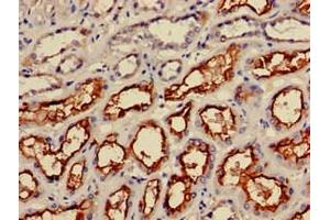 Immunohistochemistry of paraffin-embedded human kidney tissue using ABIN7156336 at dilution of 1:100 (IRS2 Antikörper  (AA 766-1001))