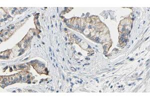 ABIN6272608 at 1/100 staining Human prostate tissue by IHC-P. (NPR1 Antikörper  (Internal Region))