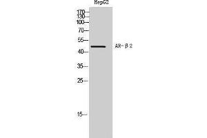 Western Blotting (WB) image for anti-Androgen Receptor beta 2 (C-Term) antibody (ABIN3183393) (Androgen Receptor beta 2 Antikörper  (C-Term))