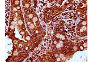 Immunohistochemistry (IHC) image for anti-Plastin 1 (PLS1) (AA 1-143) antibody (ABIN7163552)