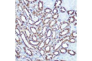 Immunohistochemistry of paraffin-embedded mouse kidney using HK1 Rabbit mAb (ABIN7267638) at dilution of 1:100 (40x lens). (Hexokinase 1 Antikörper)