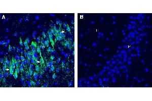 Expression of CD9 in mouse hippocampus. (CD9 Antikörper  (Extracellular))