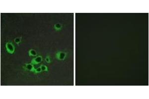 Immunofluorescence analysis of COS7 cells, using HTR2B Antibody. (Serotonin Receptor 2B Antikörper  (AA 15-64))