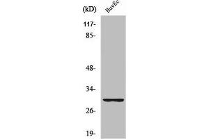 Western Blot analysis of HuvEc cells using Ribosomal Protein S4Y1 Polyclonal Antibody (RPS4Y1 Antikörper  (C-Term))