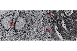 Image no. 1 for anti-4-Hydroxynonenal (HNE) antibody (ABIN335414) (HNE Antikörper)