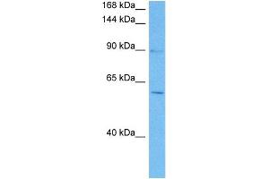 Western Blotting (WB) image for anti-Nuclear Factor of Activated T-Cells, Cytoplasmic, Calcineurin-Dependent 4 (NFATC4) (N-Term) antibody (ABIN2779435)