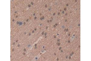 Used in DAB staining on fromalin fixed paraffin- embedded brain tissue (RNASEH2A Antikörper  (AA 1-299))