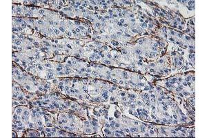 Image no. 2 for anti-Low Density Lipoprotein Receptor Adaptor Protein 1 (LDLRAP1) antibody (ABIN1496685) (LDLRAP1 Antikörper)