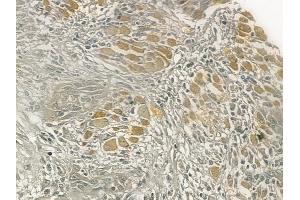 ABIN6258511 and ABIN6274725 at 1/100 staining human tongue carcinoma by IHC-P. (MRPL54 Antikörper  (Internal Region))