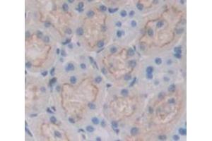 Used in DAB staining on fromalin fixed paraffin- embedded Kidney tissue (Nicotinamide Adenine Dinucleotide Phosphate Oxidase 3 (AA 221-466) Antikörper)