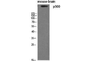 Western Blotting (WB) image for anti-E1A Binding Protein P300 (EP300) (N-Term) antibody (ABIN3186253)