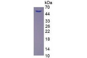 Image no. 1 for Dickkopf Homolog 1 (DKK1) (AA 36-260) protein (His tag,GST tag) (ABIN6237695) (DKK1 Protein (AA 36-260) (His tag,GST tag))