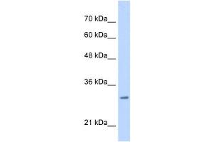 MLF2 antibody used at 0. (MLF2 Antikörper  (C-Term))