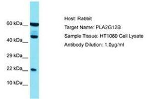 Image no. 1 for anti-Phospholipase A2, Group XIIB (PLA2G12B) (N-Term) antibody (ABIN6750703) (PLA2G12B Antikörper  (N-Term))