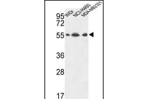 ATP5A1 Antibody (C-term) (ABIN653734 and ABIN2843039) western blot analysis in WiDr,NCI-,MDA-M cell line lysates (35 μg/lane). (ATP5A1 Antikörper  (C-Term))