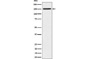 Western blot analysis of HDLBP expression in HeLa cell lysate.
