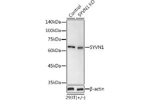 Western blot analysis of extracts from normal (control) and SYVN1 knockout (KO) 293T cells, using SYVN1 antibody (ABIN1680347, ABIN3016314, ABIN3016315 and ABIN6219717) at 1:1000 dilution. (SYVN1 Antikörper  (C-Term))