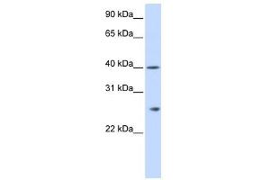 GSTK1 antibody used at 1 ug/ml to detect target protein. (GSTK1 Antikörper  (N-Term))