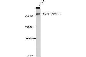 Western blot analysis of extracts of Rat lung, using SMMHC/SMMHC/MYH11 Rabbit mAb (ABIN7268745) at 1:1000 dilution. (MYH11 Antikörper)